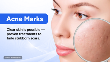 Proven Methods to Get Rid of Acne Scars and Marks for Clearer, Healthier Skin??